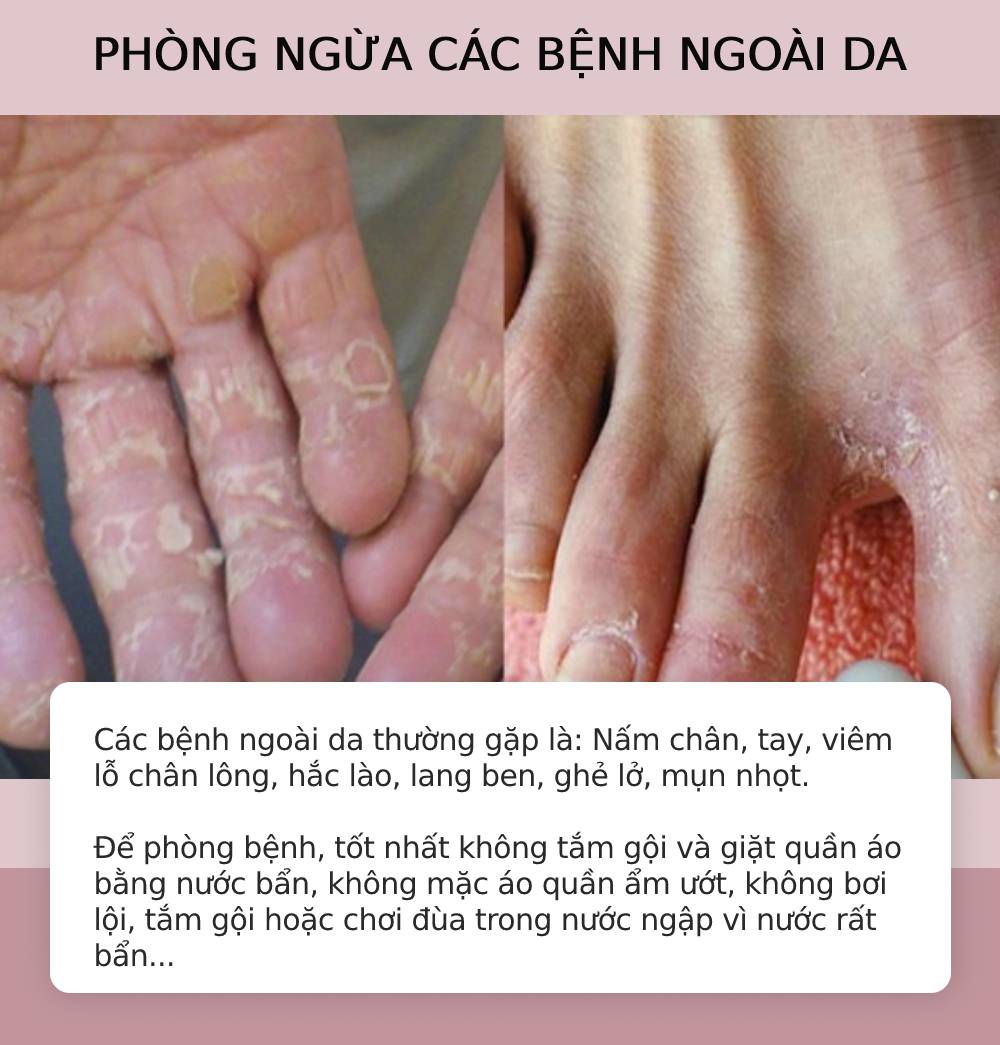 Những lưu ý đề phòng an toàn mùa mưa bão, phòng bệnh mùa mưa lũ26-min Những lưu ý đề phòng an toàn mùa mưa bão, phòng bệnh mùa mưa lũ26-min